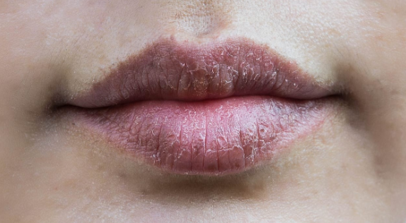 bibir