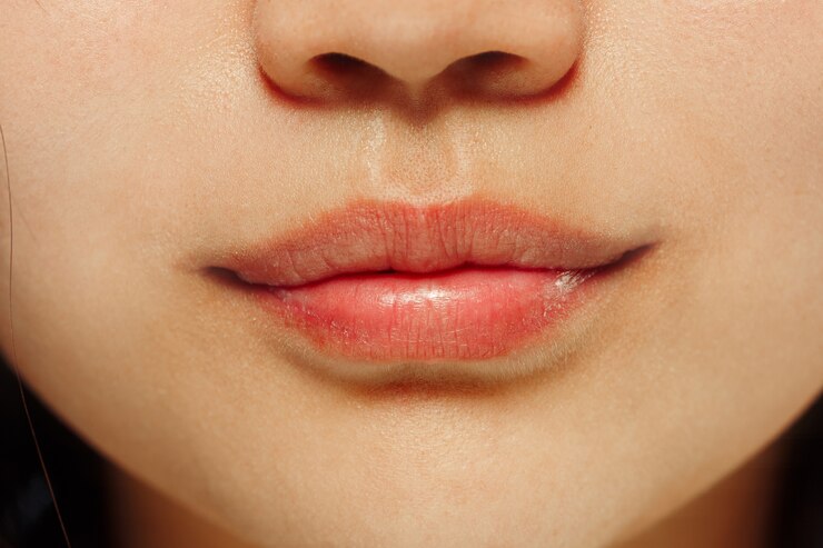Penyebab Bibir Gelap
