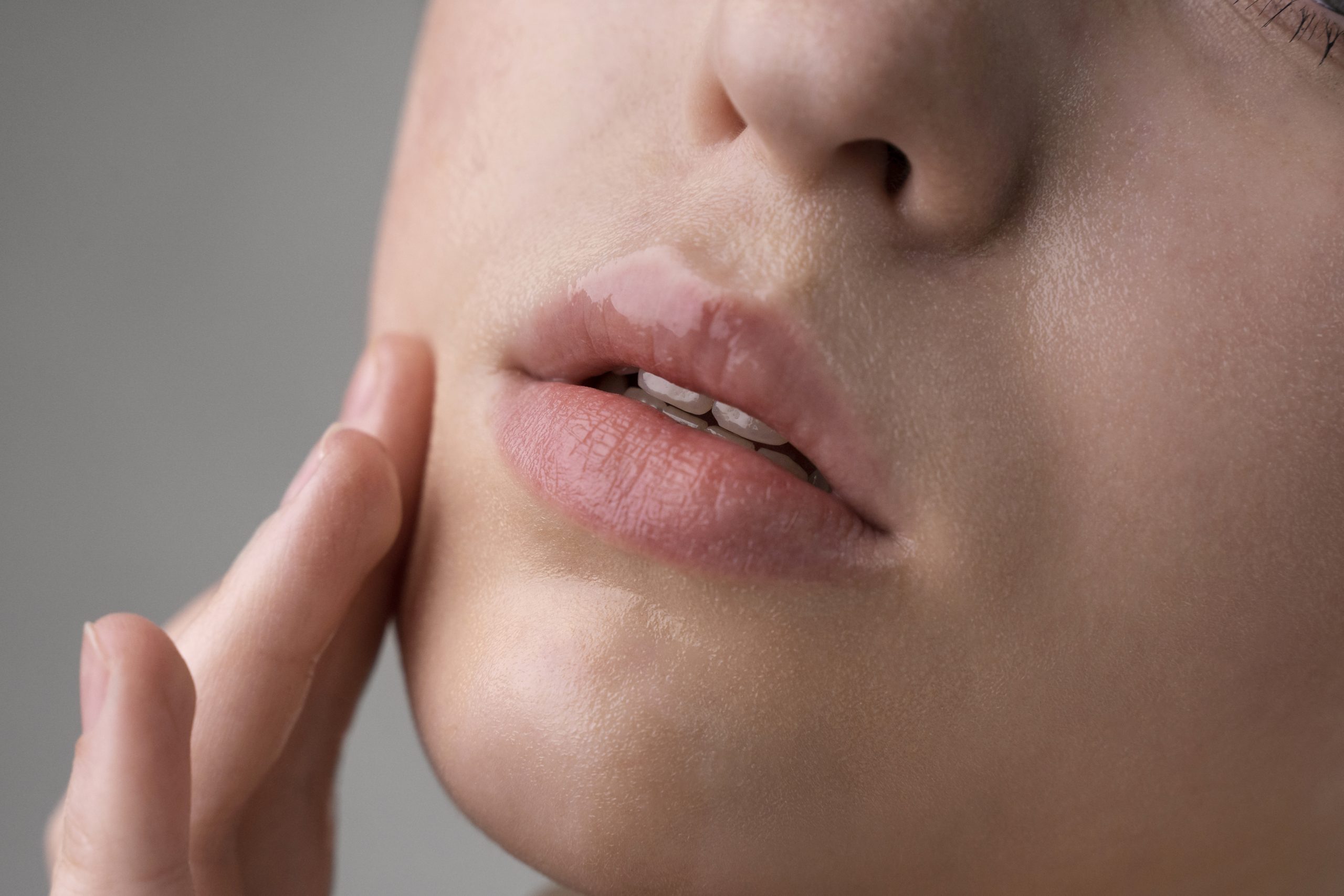 kelembapan bibir