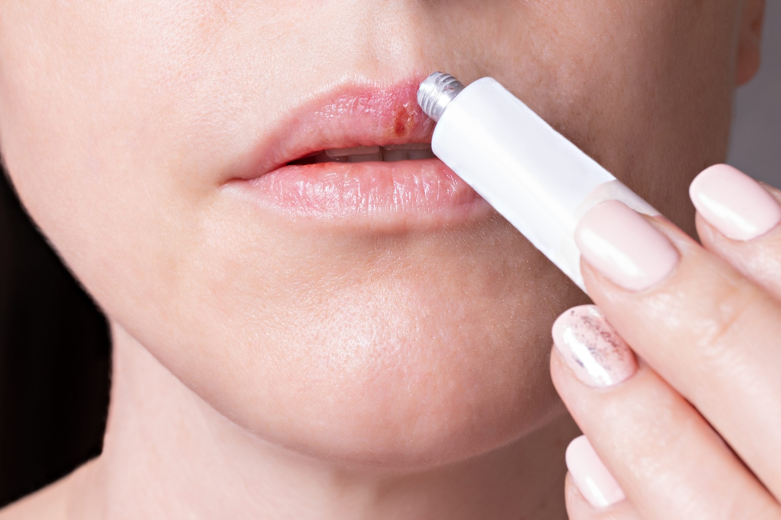 Lip Serum untuk Bibir Sensitif